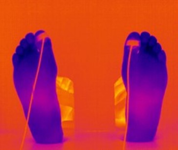 infra red image of cold sensitive feet
