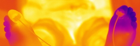 infrared image of cold sensitive feet